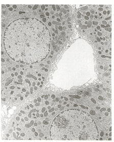  Electron Micrograph of Liver Cells (5) 